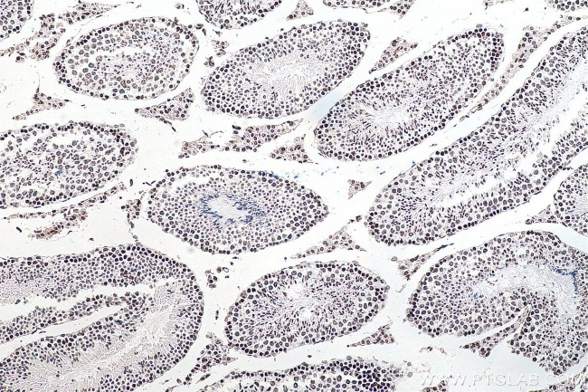 m6A Antibody in Immunohistochemistry (Paraffin) (IHC (P))