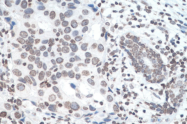 m6A Antibody in Immunohistochemistry (Paraffin) (IHC (P))