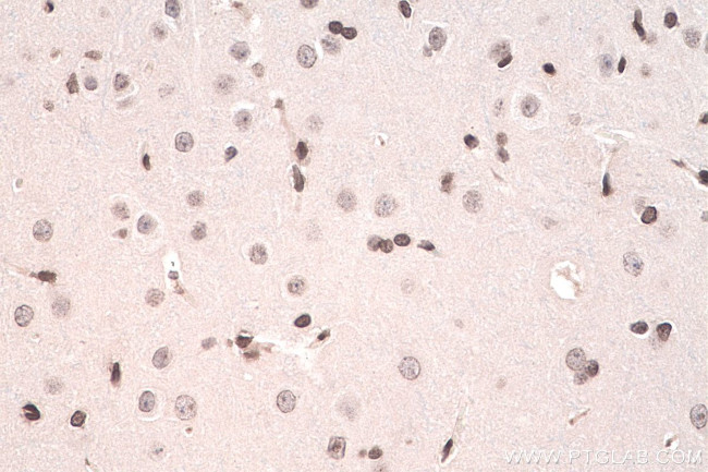 m6A Antibody in Immunohistochemistry (Paraffin) (IHC (P))