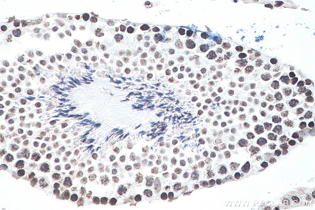 m6A Antibody in Immunohistochemistry (Paraffin) (IHC (P))