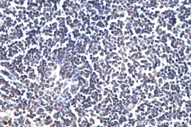 m6A Antibody in Immunohistochemistry (Paraffin) (IHC (P))