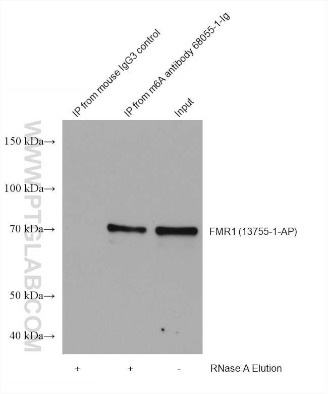 m6A Antibody in Immunoprecipitation (IP)