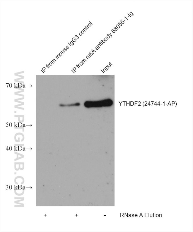 m6A Antibody in Immunoprecipitation (IP)