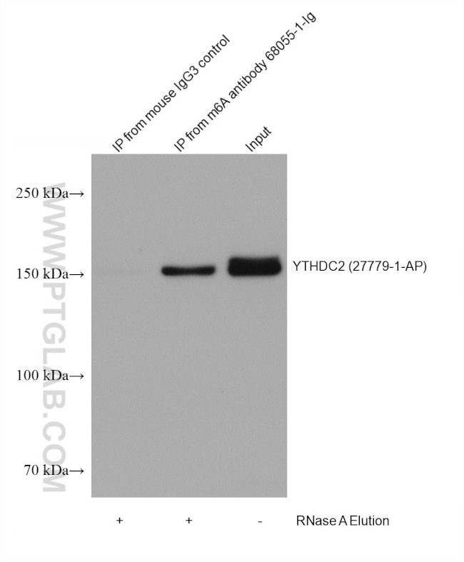 m6A Antibody in Immunoprecipitation (IP)