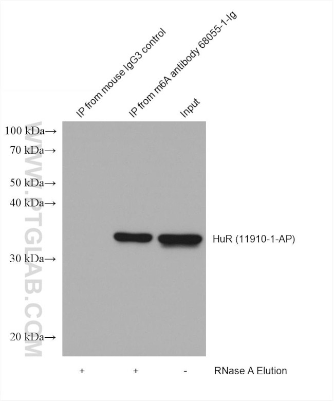 m6A Antibody in Immunoprecipitation (IP)