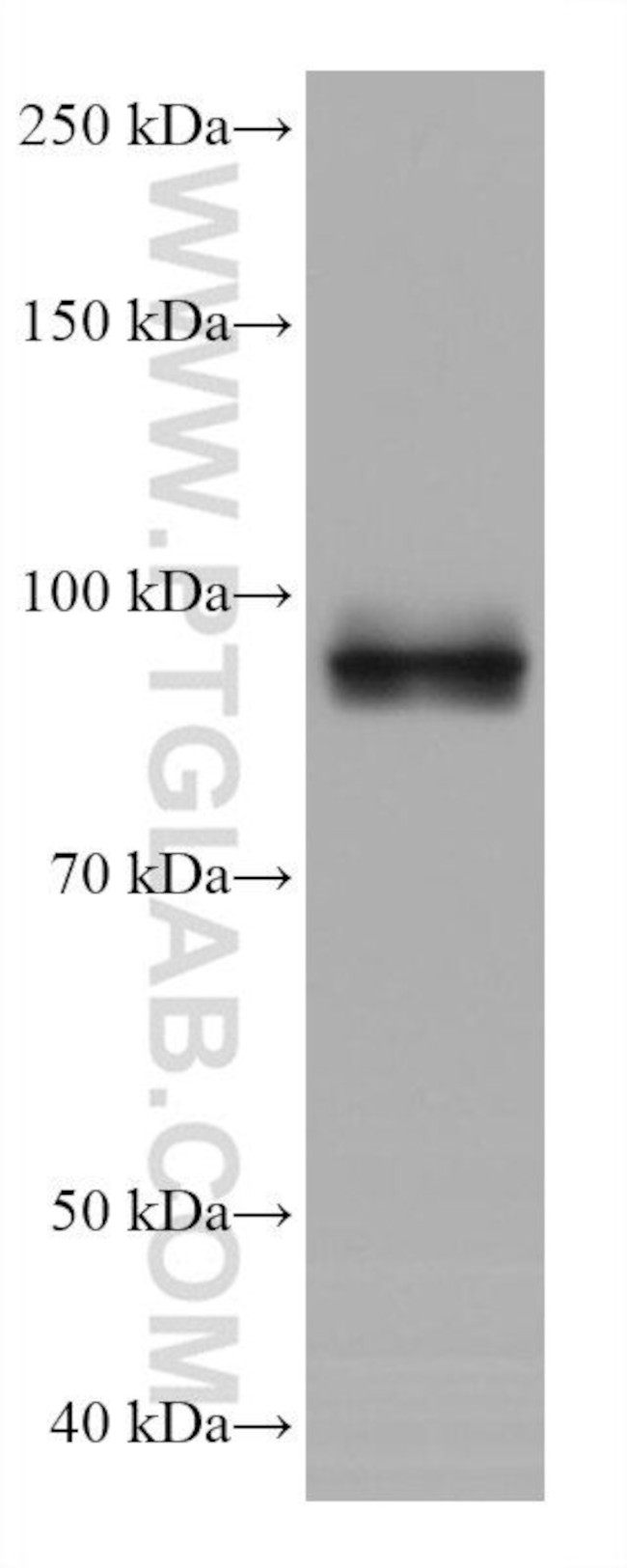 GEN1 Antibody in Western Blot (WB)