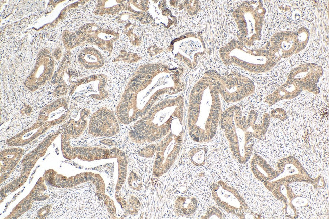 INO80 Antibody in Immunohistochemistry (Paraffin) (IHC (P))