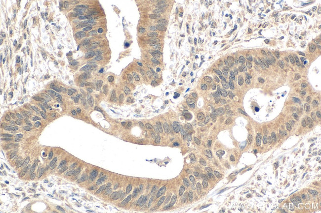 INO80 Antibody in Immunohistochemistry (Paraffin) (IHC (P))