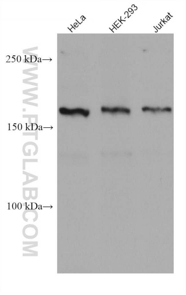 INO80 Antibody in Western Blot (WB)