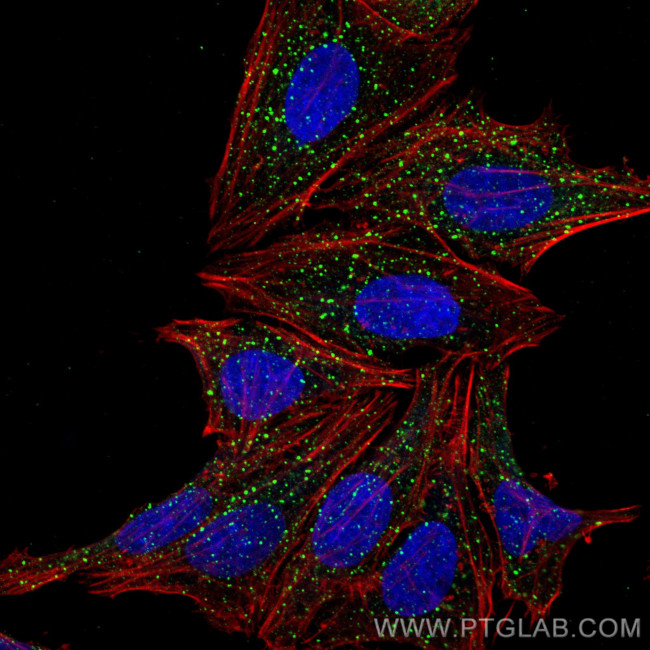 EEA1 Antibody in Immunocytochemistry (ICC/IF)