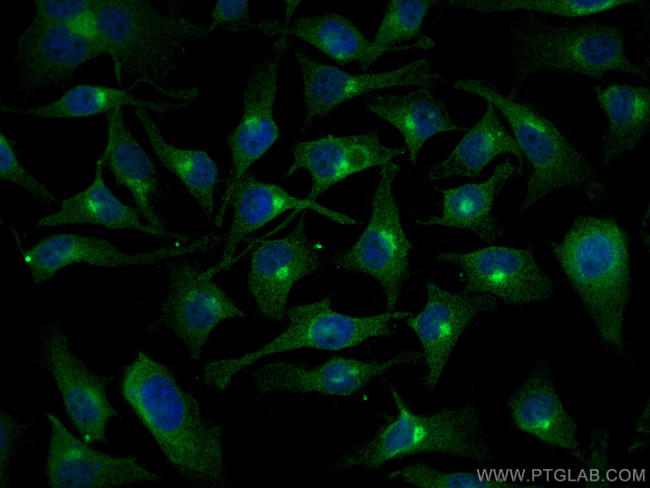 ARF1 Antibody in Immunocytochemistry (ICC/IF)