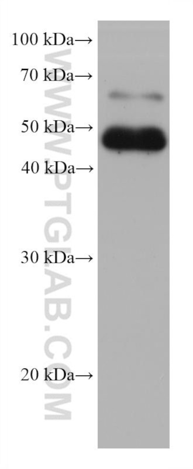 STRA8 Antibody in Western Blot (WB)