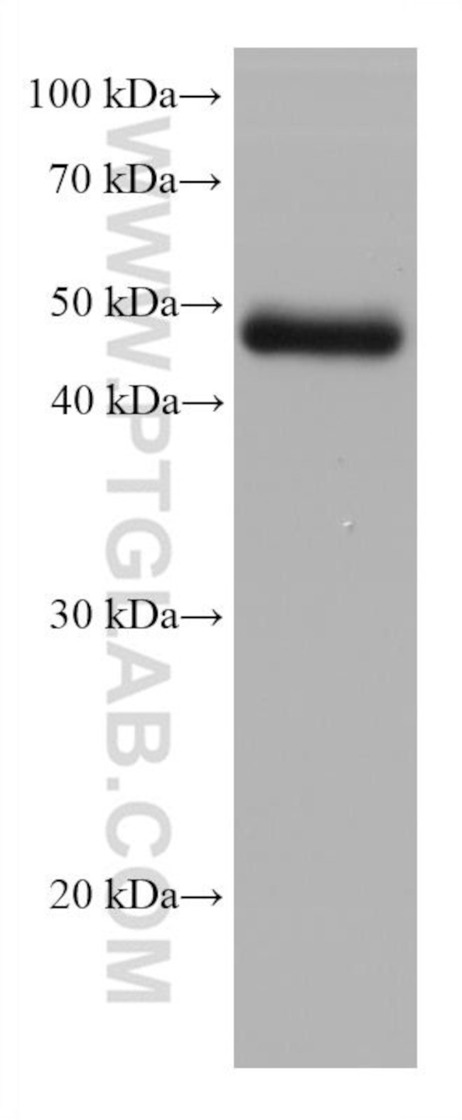 STRA8 Antibody in Western Blot (WB)