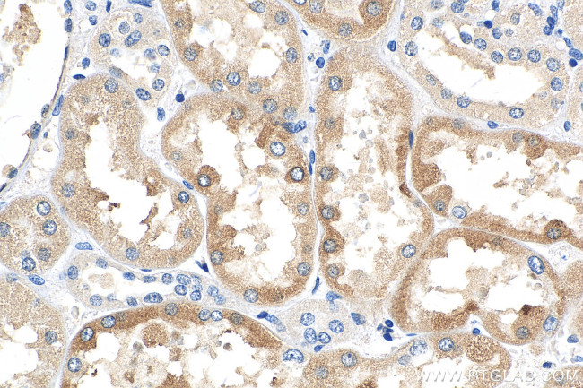 FATP2 Antibody in Immunohistochemistry (Paraffin) (IHC (P))