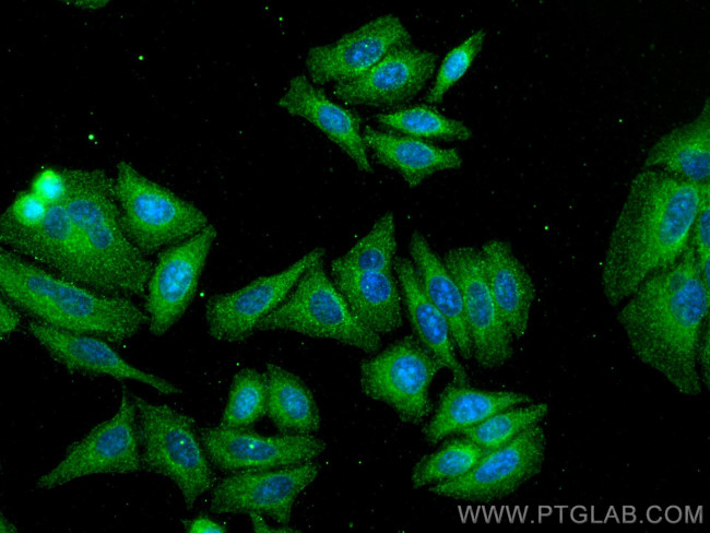 BAG3 Antibody in Immunocytochemistry (ICC/IF)