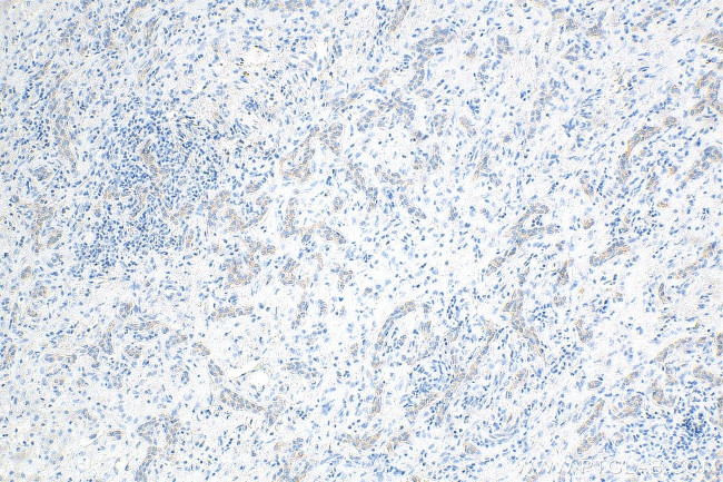 LASP1 Antibody in Immunohistochemistry (Paraffin) (IHC (P))