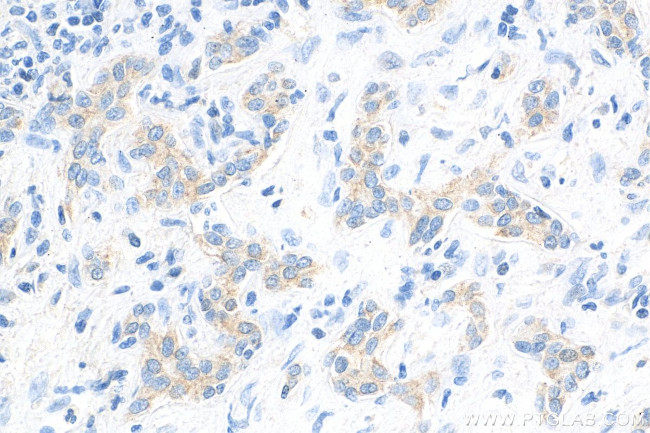 LASP1 Antibody in Immunohistochemistry (Paraffin) (IHC (P))