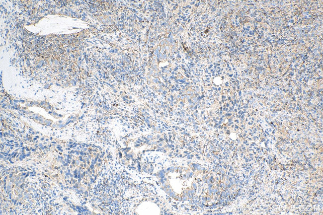 LASP1 Antibody in Immunohistochemistry (Paraffin) (IHC (P))