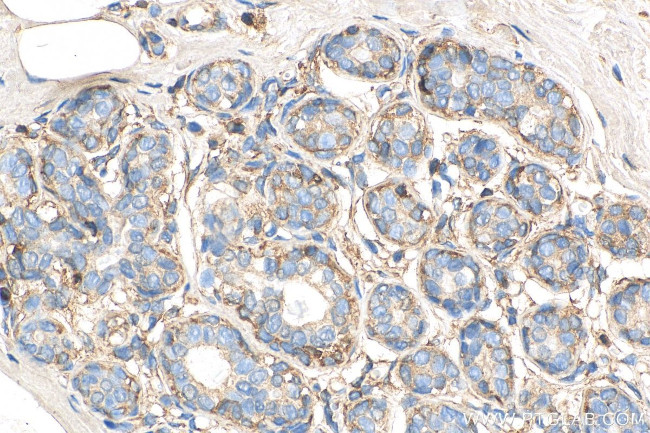 LASP1 Antibody in Immunohistochemistry (Paraffin) (IHC (P))