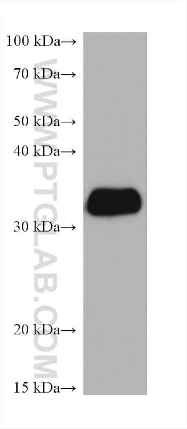 LASP1 Antibody in Western Blot (WB)