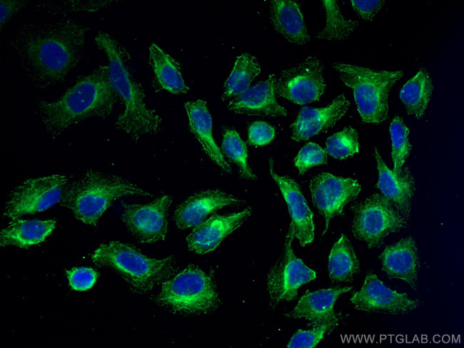 NCAPG Antibody in Immunocytochemistry (ICC/IF)