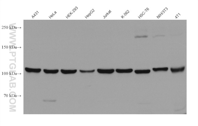 NCAPG Antibody in Western Blot (WB)