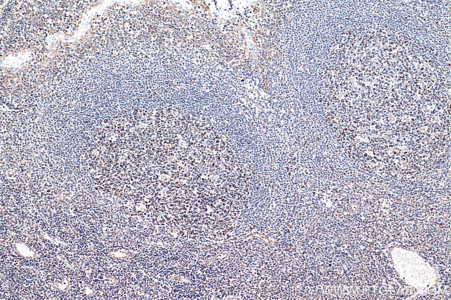 C1QBP Antibody in Immunohistochemistry (Paraffin) (IHC (P))