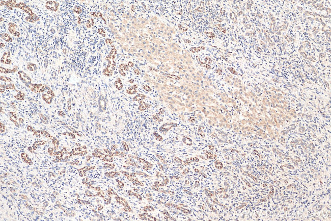 C1QBP Antibody in Immunohistochemistry (Paraffin) (IHC (P))