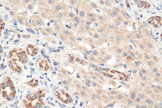 C1QBP Antibody in Immunohistochemistry (Paraffin) (IHC (P))