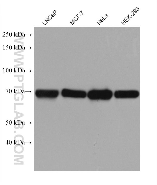 FKBP10 Antibody in Western Blot (WB)