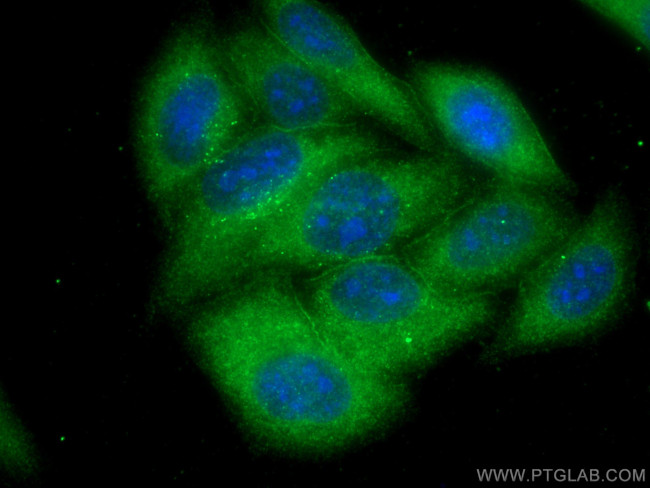 Annexin VI Antibody in Immunocytochemistry (ICC/IF)