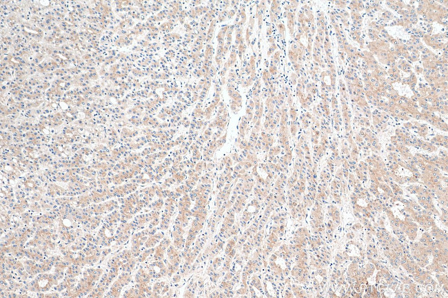 p115, USO1 Antibody in Immunohistochemistry (Paraffin) (IHC (P))