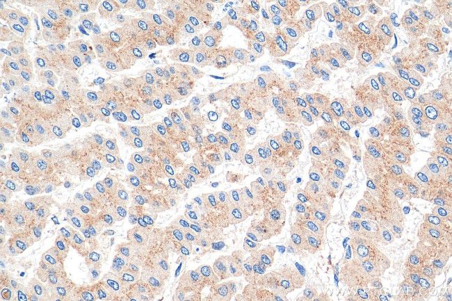 p115, USO1 Antibody in Immunohistochemistry (Paraffin) (IHC (P))