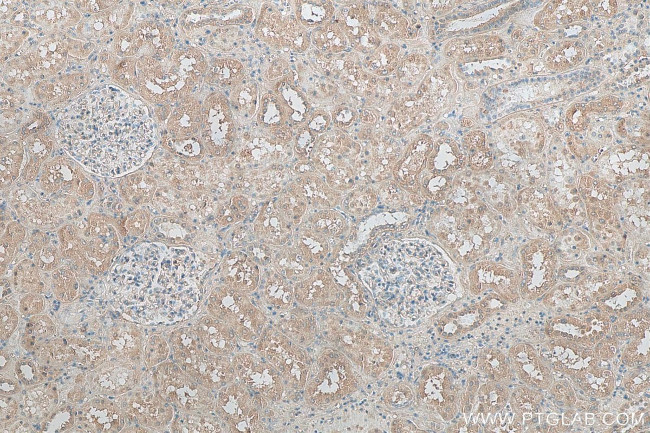 NLRP3 Antibody in Immunohistochemistry (Paraffin) (IHC (P))