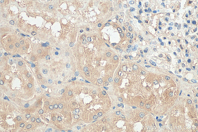 NLRP3 Antibody in Immunohistochemistry (Paraffin) (IHC (P))