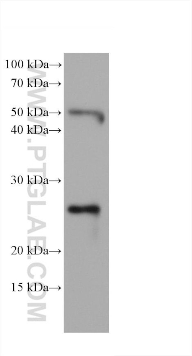 Bcl2 Antibody in Western Blot (WB)