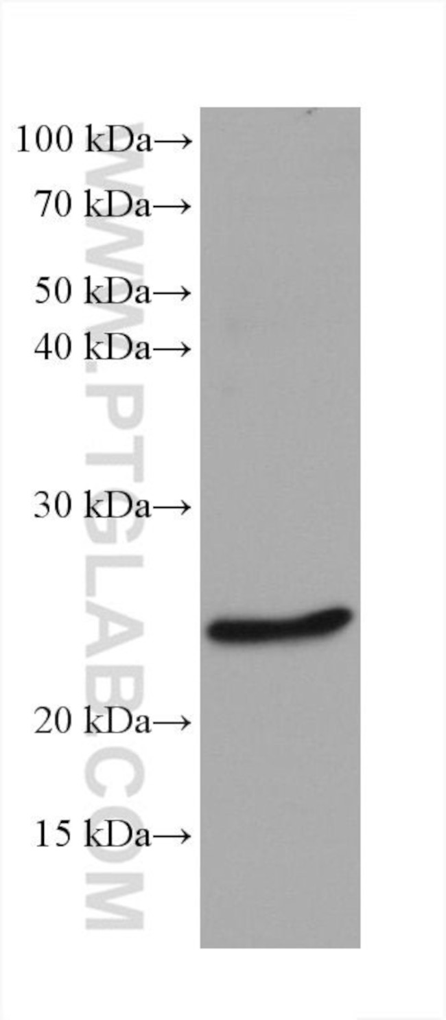 Bcl2 Antibody in Western Blot (WB)