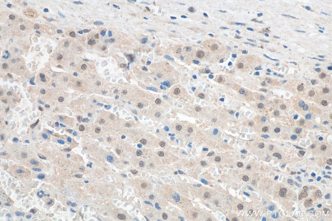 FTO Antibody in Immunohistochemistry (Paraffin) (IHC (P))