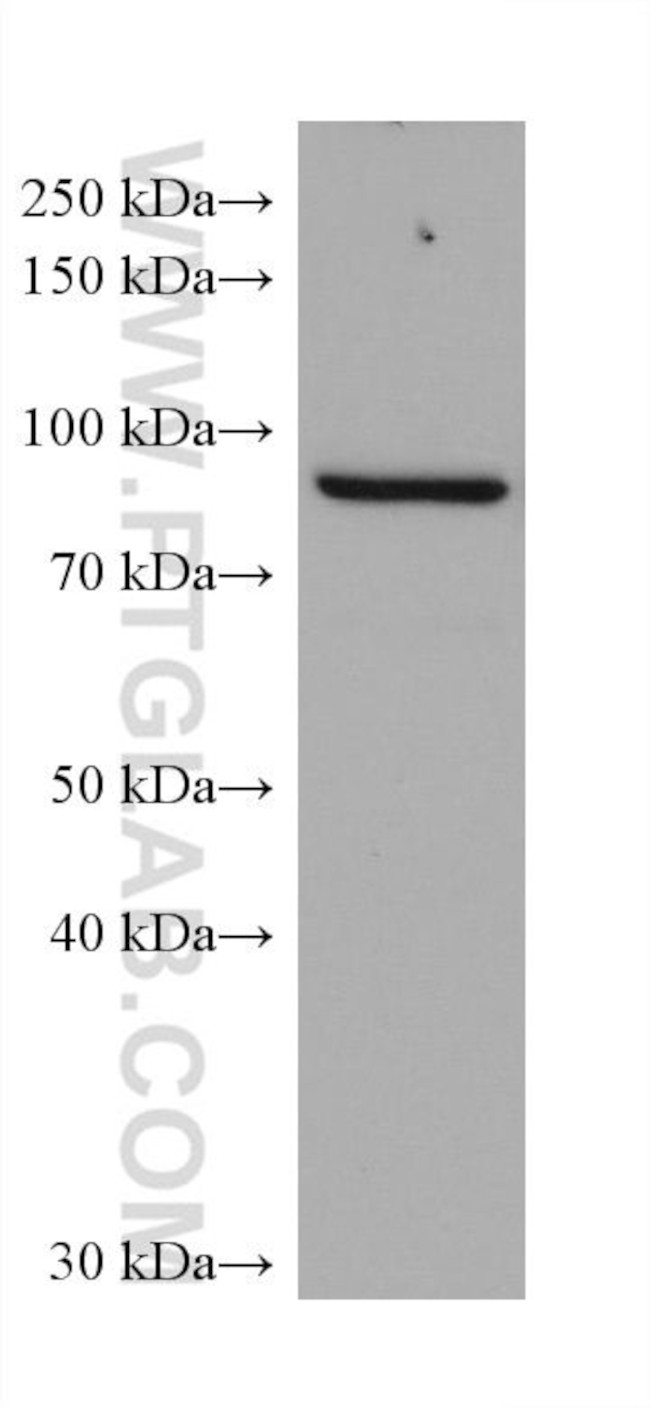 ADAM8 Antibody in Western Blot (WB)