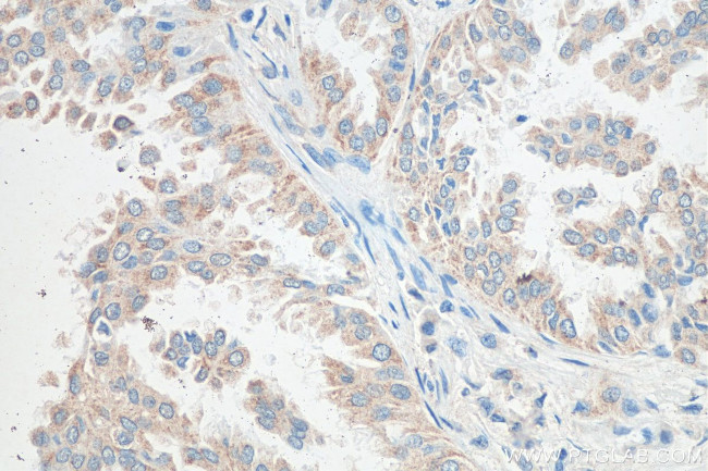 PGAM5 Antibody in Immunohistochemistry (Paraffin) (IHC (P))