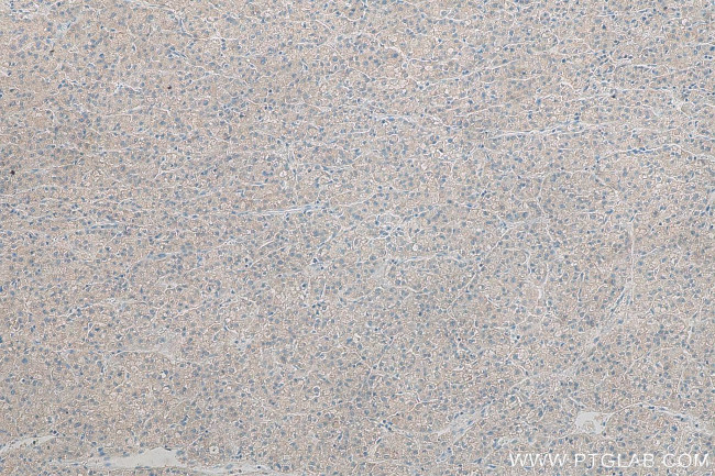 PGAM5 Antibody in Immunohistochemistry (Paraffin) (IHC (P))