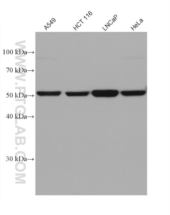 ME1 Antibody in Western Blot (WB)