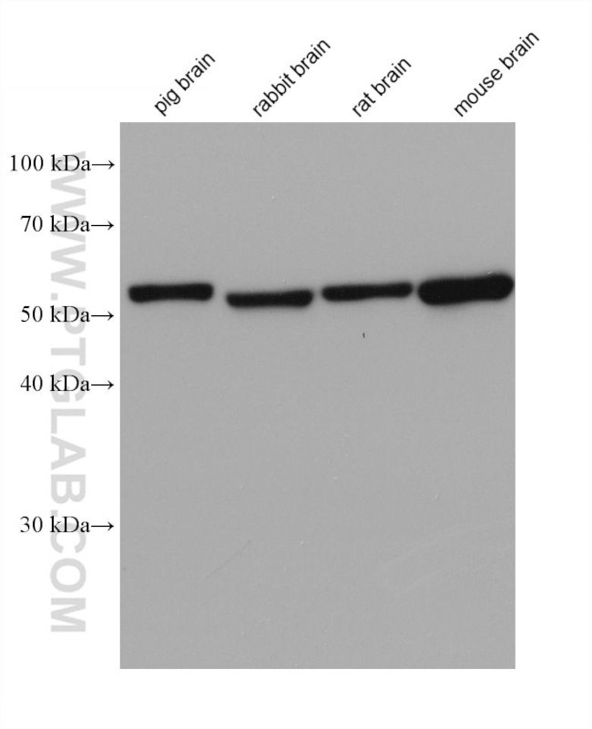 ME1 Antibody in Western Blot (WB)