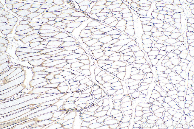 Dystrophin Antibody in Immunohistochemistry (Paraffin) (IHC (P))