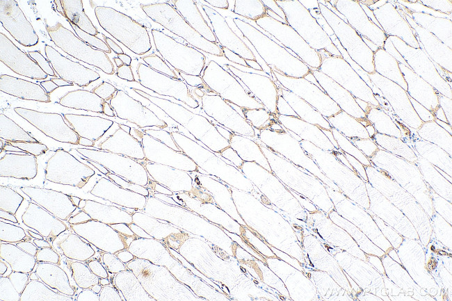 Dystrophin Antibody in Immunohistochemistry (Paraffin) (IHC (P))