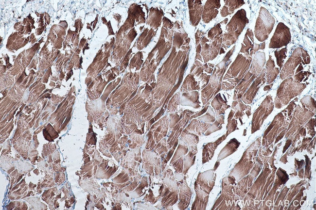 LPIN1 Antibody in Immunohistochemistry (Paraffin) (IHC (P))