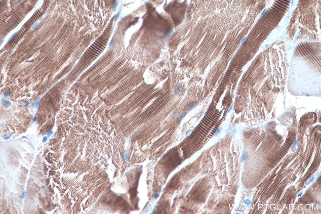 LPIN1 Antibody in Immunohistochemistry (Paraffin) (IHC (P))