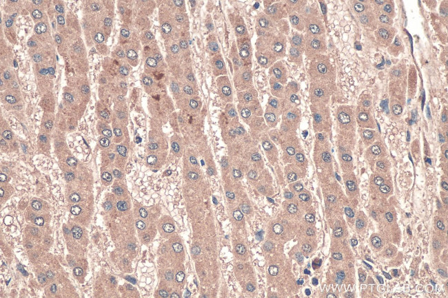 LPIN1 Antibody in Immunohistochemistry (Paraffin) (IHC (P))