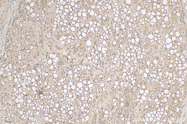 RAP1A Antibody in Immunohistochemistry (Paraffin) (IHC (P))