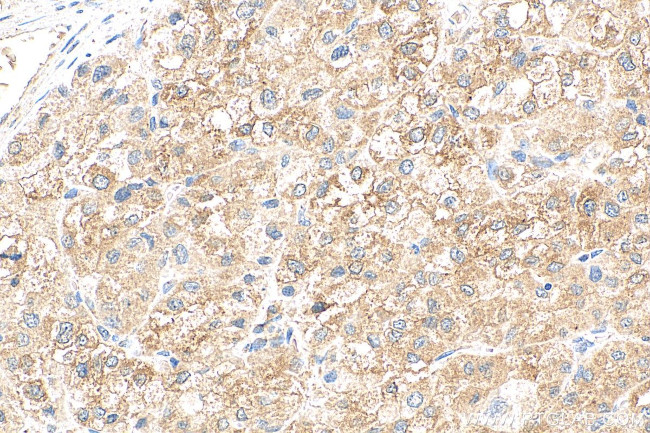 MYDGF/C19orf10 Antibody in Immunohistochemistry (Paraffin) (IHC (P))